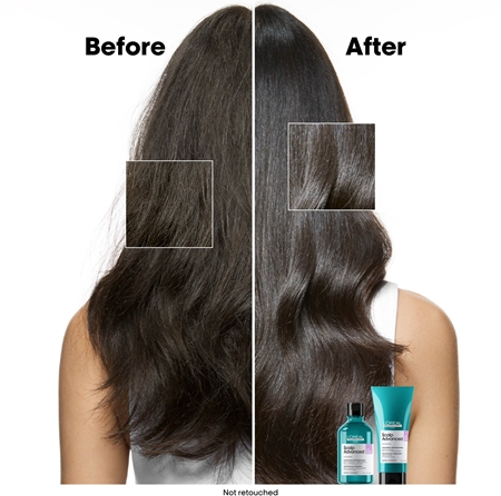 L’Oréal Professionnel Serie Expert Scalp Advanced шампунь для чутливої та подразненої шкіри голови