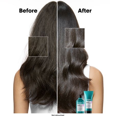 L’Oréal Professionnel Serie Expert Scalp Advanced šampón pre citlivú a podráždenú pokožku hlavy