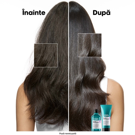 L’Oréal Professionnel Serie Expert Scalp Advanced Șampon pentru scalp sensibil și iritat