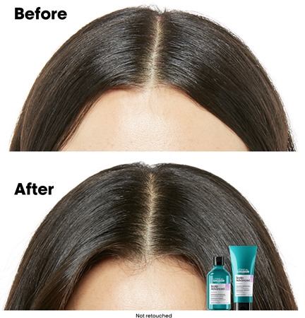 L’Oréal Professionnel Serie Expert Scalp Advanced šampón pre citlivú a podráždenú pokožku hlavy