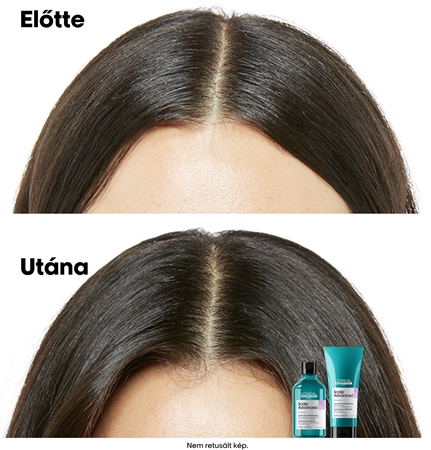 L’Oréal Professionnel Serie Expert Scalp Advanced Sampon érzékeny és rritált fejbőrre