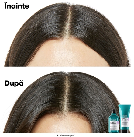 L’Oréal Professionnel Serie Expert Scalp Advanced Șampon pentru scalp sensibil și iritat