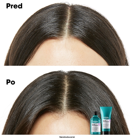 L’Oréal Professionnel Serie Expert Scalp Advanced šampón pre citlivú a podráždenú pokožku hlavy