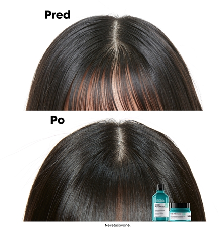 L’Oréal Professionnel Serie Expert Scalp Advanced šampón a maska 2 v 1 pre mastné vlasy a vlasovú pokožku