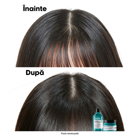 L’Oréal Professionnel Serie Expert Scalp Advanced șampon și mască 2 în 1 pentru par si scalp gras
