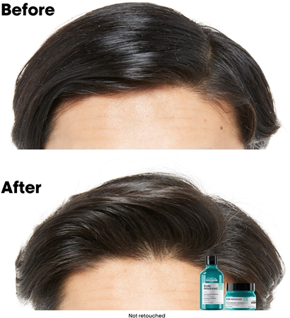 L’Oréal Professionnel Serie Expert Scalp Advanced šampūnas ir kaukė „du viename“ riebiems plaukams ir riebiai galvos odai