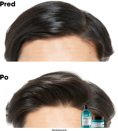 L’Oréal Professionnel Serie Expert Scalp Advanced šampón a maska 2 v 1 pre mastné vlasy a vlasovú pokožku
