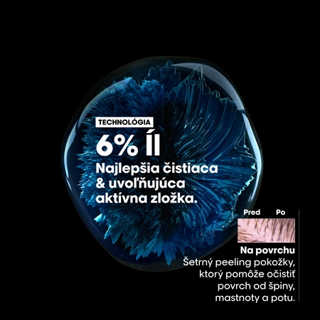 L’Oréal Professionnel Serie Expert Scalp Advanced šampón a maska 2 v 1 pre mastné vlasy a vlasovú pokožku