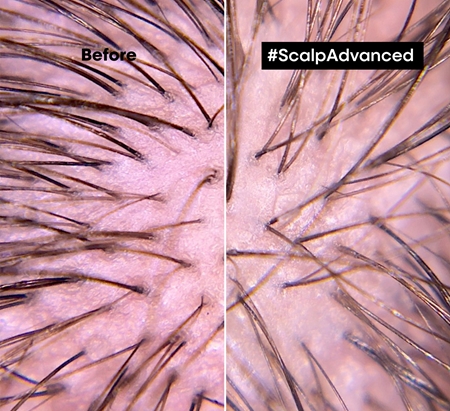 L’Oréal Professionnel Serie Expert Scalp Advanced Haarpflege für Haare und Kopfhaut