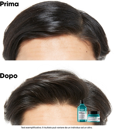 L’Oréal Professionnel Serie Expert Scalp Advanced shampoo detergente per cuoi capelluti grassi