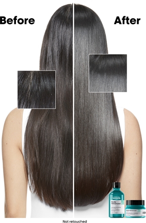 L’Oréal Professionnel Serie Expert Scalp Advanced valomasis šampūnas riebiai galvos odai