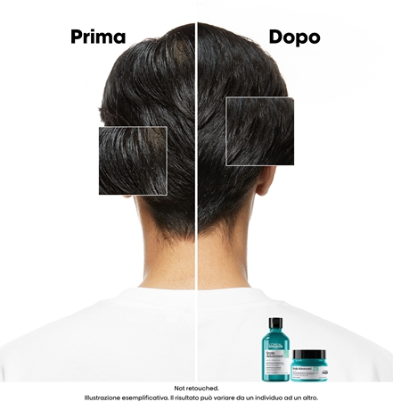 L’Oréal Professionnel Serie Expert Scalp Advanced shampoo detergente per cuoi capelluti grassi