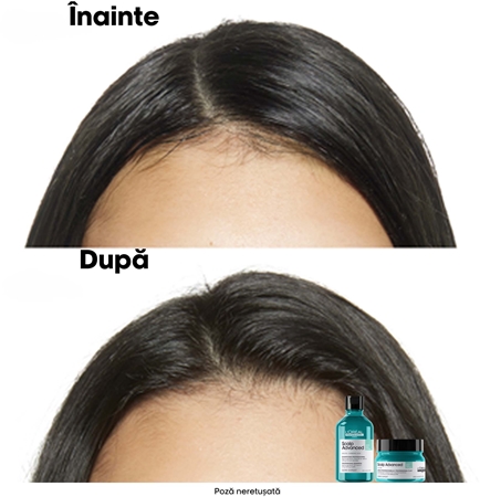 L’Oréal Professionnel Serie Expert Scalp Advanced sampon pentru curatare pentru un scalp seboreic