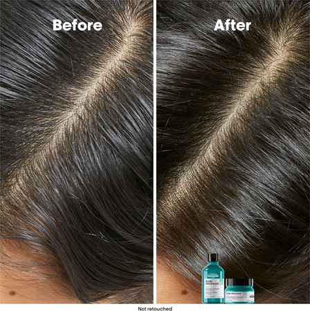 L’Oréal Professionnel Serie Expert Scalp Advanced valomasis šampūnas riebiai galvos odai