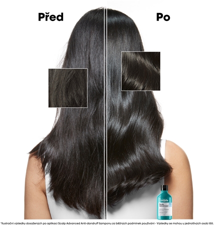 L’Oréal Professionnel Serie Expert Scalp Advanced šampon proti lupům