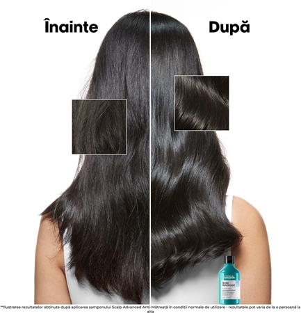 L’Oréal Professionnel Serie Expert Scalp Advanced sampon anti-matreata