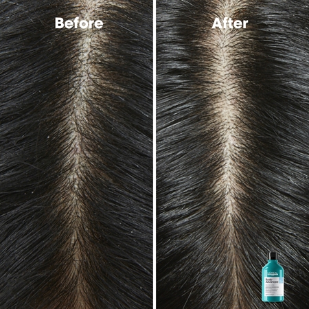 L’Oréal Professionnel Serie Expert Scalp Advanced champô anticaspa