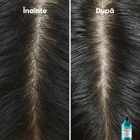L’Oréal Professionnel Serie Expert Scalp Advanced sampon anti-matreata