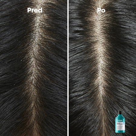 L’Oréal Professionnel Serie Expert Scalp Advanced šampón proti lupinám