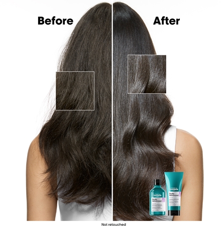L’Oréal Professionnel Serie Expert Scalp Advanced шампунь для чутливої та подразненої шкіри голови