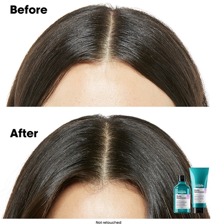 L’Oréal Professionnel Serie Expert Scalp Advanced шампунь для чутливої та подразненої шкіри голови