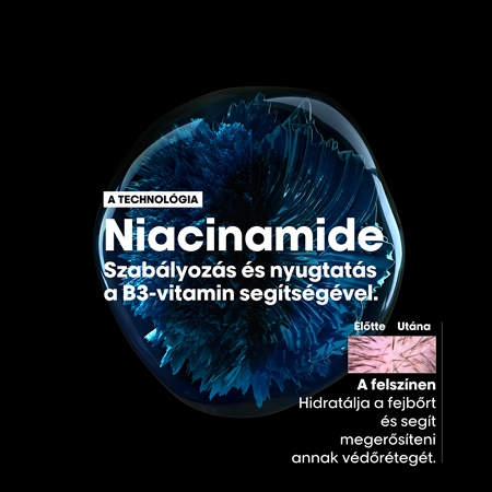 L’Oréal Professionnel Serie Expert Scalp Advanced Sampon érzékeny és rritált fejbőrre