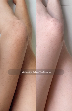 Loving Tan Deluxe Tan Remover odstraňovač opálenia na telo