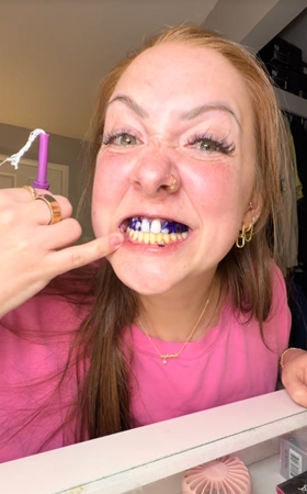 LYSS V34 whitening strips