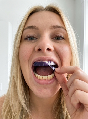 LYSS V34 whitening strips