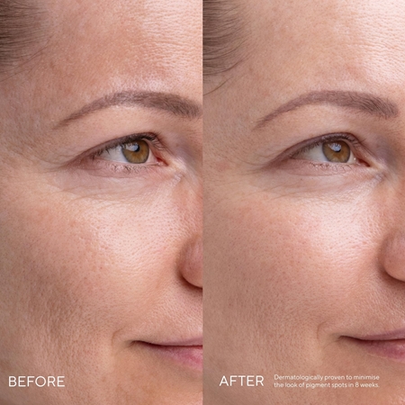 MÁDARA Kojic Alternative Pigment Serum Serum for pigment spot correction