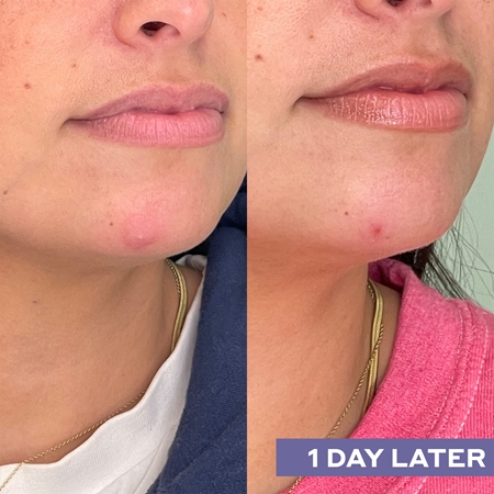Mario Badescu Repairing Facial Spray With Hypochlorous Acid Restorative Skin Spray with soothing effect