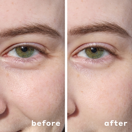 Mario Badescu Hydrogel Under Eye Patches hydrogel pads to treat swelling and dark circles