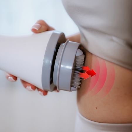 Medivon Cello Massage Device for cellulite