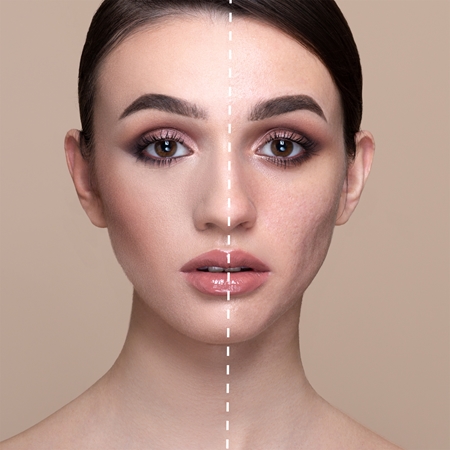 Mesauda Pro Light hydratačný korektor