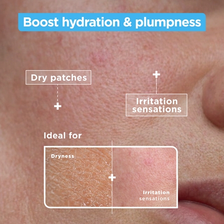Mixa Anti-Dryness umirujući i hidratantni serum