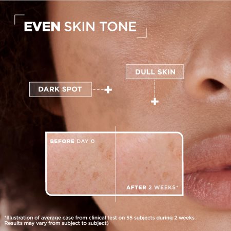 MIXA Sensitive Skin Expert sérum anti-manchas de pigmentação