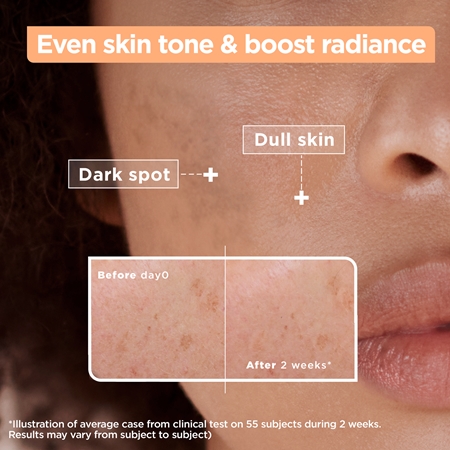 Mixa Anti-Dark Spot ser impotriva petelor