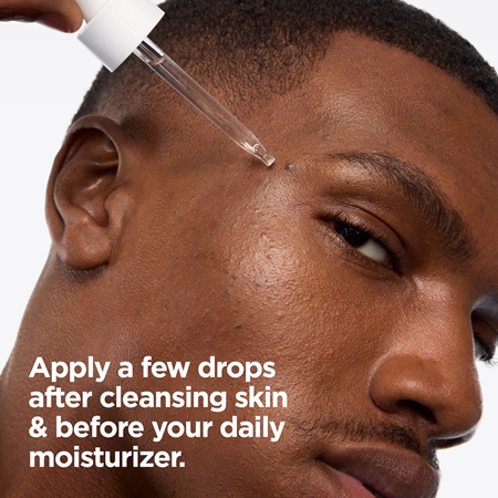 Mixa Anti-Dark Spot ser impotriva petelor