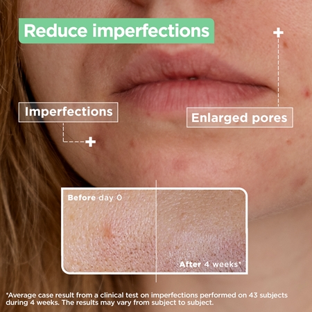 Mixa Anti-Imperfection Serum for problem skin, acne