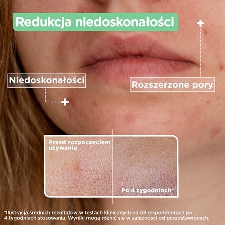 Mixa LAB Expert serum do skóry z problemami