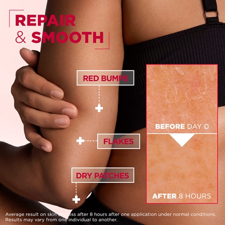 Mixa Urea Cica Repair+ crème pour le corps régénérante pour peaux très sèches