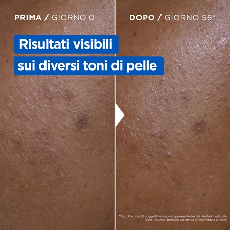 Mixa Niacinamide Bright crema corpo illuminante e idratante