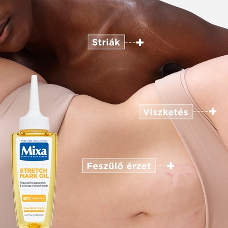 Mixa Stretch Mark Oil olaj striák ellen