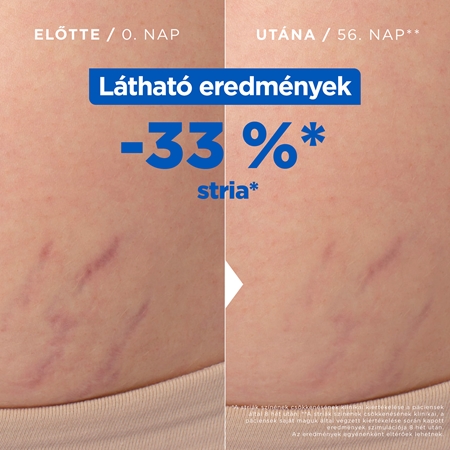 Mixa Stretch Mark Oil olaj striák ellen