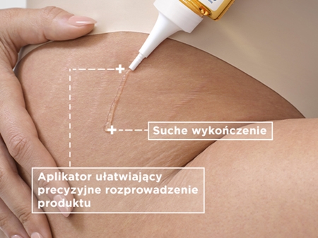 Mixa Stretch Mark Oil olejek przeciw rozstępom