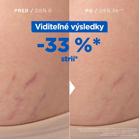 Mixa Stretch Mark Oil olej proti striám