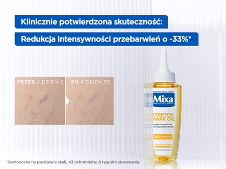 Mixa Stretch Mark Oil olejek przeciw rozstępom