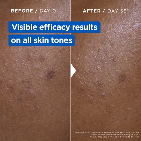Mixa Niacinamide Bright multifunkcyjny krem krem intensywnie nawilżający przeciw przebarwieniom