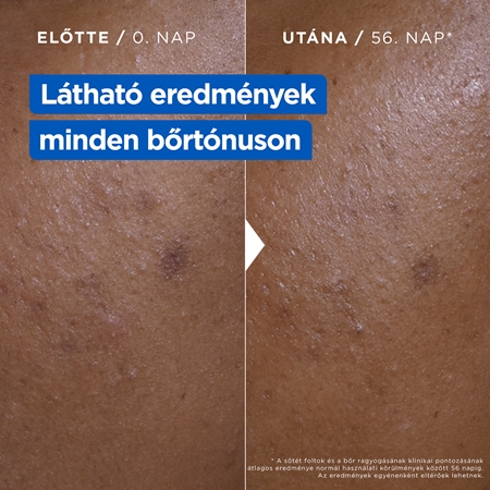 Mixa Niacinamide Bright intenzíven hidratáló krém a sötét foltok ellen