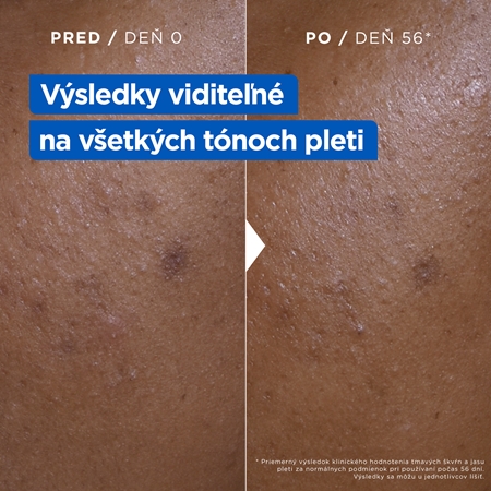 Mixa Niacinamide Bright intenzívne hydratačný krém proti tmavým škvrnám